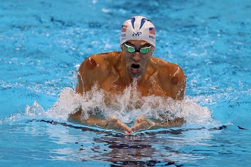 Fisioterapeuta, Mônica Rivero, explica técnica da ventosaterapia / Foto: Al Bello/Getty Images